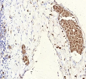 Anti-FLI1 antibody [rFLI1/9614] used in IHC (Paraffin sections) (IHC-P). GTX05013