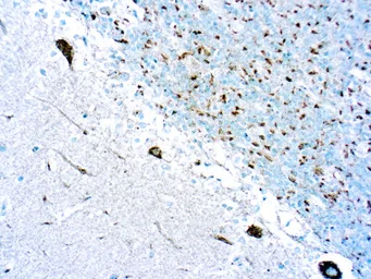 Anti-Trk antibody (ready-to-use) used in IHC (Paraffin sections) (IHC-P). GTX05015