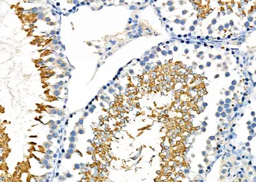 Anti-GPX4 antibody used in IHC (Paraffin sections) (IHC-P). GTX05018