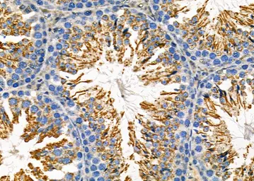 Anti-GPX4 antibody used in IHC (Paraffin sections) (IHC-P). GTX05018