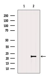 Anti-GPX4 antibody used in Western Blot (WB). GTX05018