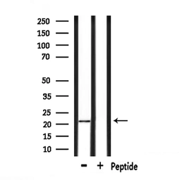 Anti-GPX4 antibody used in Western Blot (WB). GTX05018