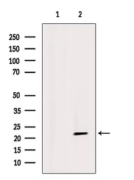 Anti-GPX4 antibody used in Western Blot (WB). GTX05018