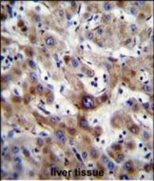 Anti-SLC25A6 antibody used in IHC (Paraffin sections) (IHC-P). GTX05019