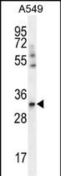 Anti-SLC25A6 antibody used in Western Blot (WB). GTX05019