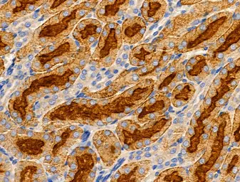Anti-SLC25A6 antibody used in IHC (Paraffin sections) (IHC-P). GTX05020