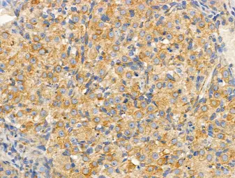 Anti-SLC25A6 antibody used in IHC (Paraffin sections) (IHC-P). GTX05020