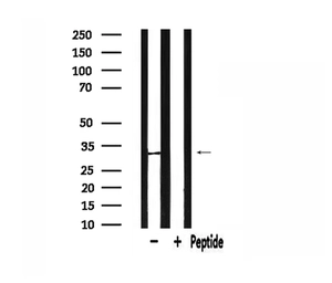 Anti-SLC25A6 antibody used in Western Blot (WB). GTX05020