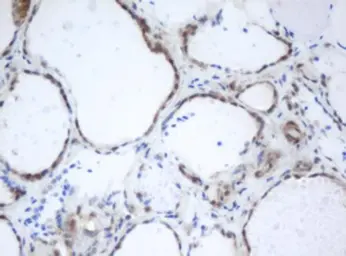 Anti-PRR11 antibody [OTI3C8] used in IHC (Paraffin sections) (IHC-P). GTX05021