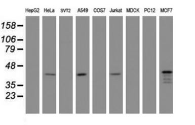 Anti-PRR11 antibody [OTI3C8] used in Western Blot (WB). GTX05021