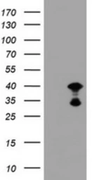 Anti-PRR11 antibody [OTI3C8] used in Western Blot (WB). GTX05021