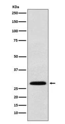 Anti-KGF antibody [26F04] used in Western Blot (WB). GTX05024