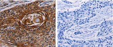 Anti-KGF antibody used in IHC (Paraffin sections) (IHC-P). GTX05025