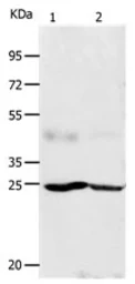 Anti-KGF antibody used in Western Blot (WB). GTX05025