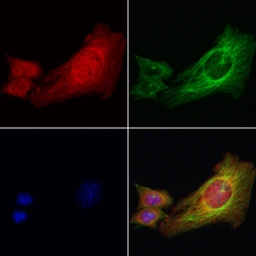 Anti-IRE1 alpha (phospho Ser724) antibody used in Immunocytochemistry/ Immunofluorescence (ICC/IF). GTX05026