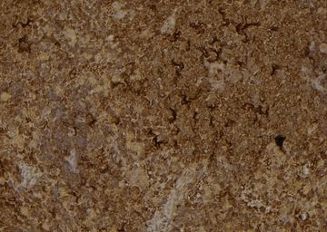 Anti-IRE1 alpha (phospho Ser724) antibody used in IHC (Paraffin sections) (IHC-P). GTX05026