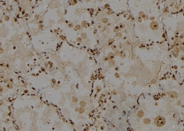 Anti-IRE1 alpha (phospho Ser724) antibody used in IHC (Paraffin sections) (IHC-P). GTX05026