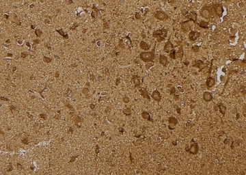 Anti-IRE1 alpha (phospho Ser724) antibody used in IHC (Paraffin sections) (IHC-P). GTX05026