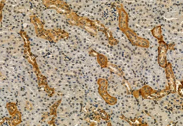 Anti-IRE1 alpha (phospho Ser724) antibody used in IHC (Paraffin sections) (IHC-P). GTX05026