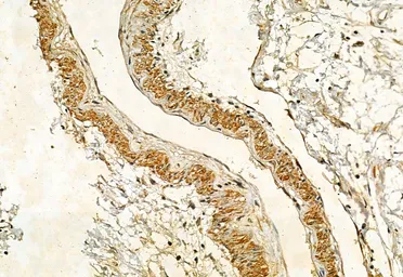Anti-IRE1 alpha (phospho Ser724) antibody used in IHC (Paraffin sections) (IHC-P). GTX05026