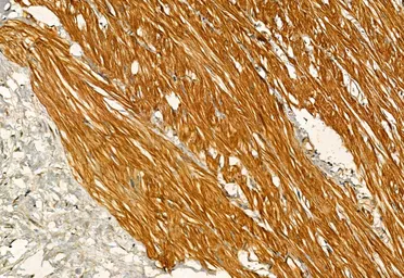 Anti-IRE1 alpha (phospho Ser724) antibody used in IHC (Paraffin sections) (IHC-P). GTX05026