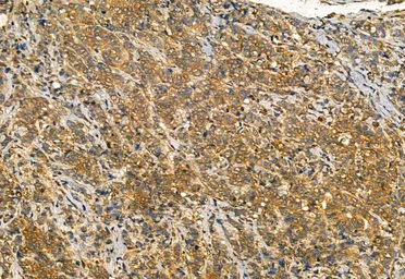 Anti-IRE1 alpha (phospho Ser724) antibody used in IHC (Paraffin sections) (IHC-P). GTX05026