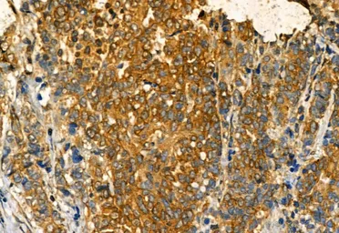 Anti-IRE1 alpha (phospho Ser724) antibody used in IHC (Paraffin sections) (IHC-P). GTX05026