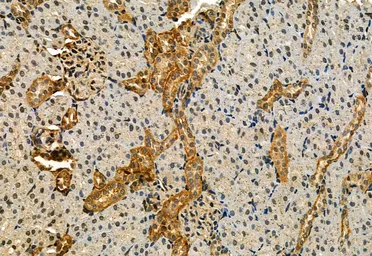 Anti-IRE1 alpha (phospho Ser724) antibody used in IHC (Paraffin sections) (IHC-P). GTX05026