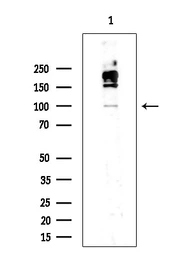 Anti-IRE1 alpha (phospho Ser724) antibody used in Western Blot (WB). GTX05026