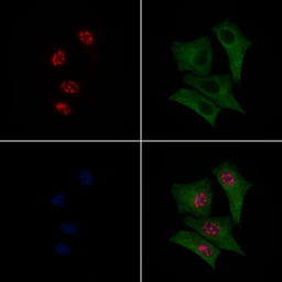 Anti-IKB alpha (phospho Ser32/Ser36) antibody used in Immunocytochemistry/ Immunofluorescence (ICC/IF). GTX05029