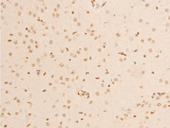 Anti-IKB alpha (phospho Ser32/Ser36) antibody used in IHC (Paraffin sections) (IHC-P). GTX05029
