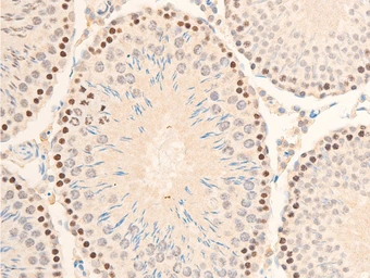Anti-IKB alpha (phospho Ser32/Ser36) antibody used in IHC (Paraffin sections) (IHC-P). GTX05029