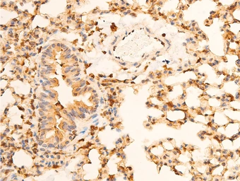 Anti-IKB alpha (phospho Ser32/Ser36) antibody used in IHC (Paraffin sections) (IHC-P). GTX05029