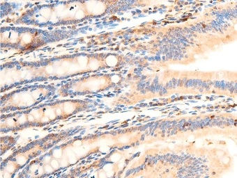 Anti-IKB alpha (phospho Ser32/Ser36) antibody used in IHC (Paraffin sections) (IHC-P). GTX05029