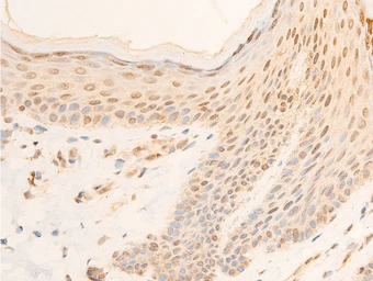 Anti-IKB alpha (phospho Ser32/Ser36) antibody used in IHC (Paraffin sections) (IHC-P). GTX05029