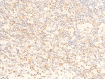 Anti-IKB alpha (phospho Ser32/Ser36) antibody used in IHC (Paraffin sections) (IHC-P). GTX05029