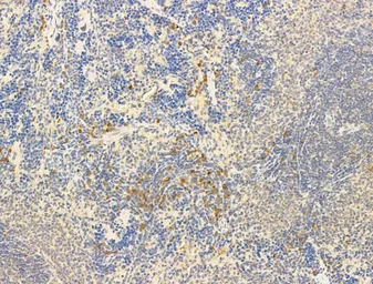 Anti-IKB alpha (phospho Ser32/Ser36) antibody used in IHC (Paraffin sections) (IHC-P). GTX05029