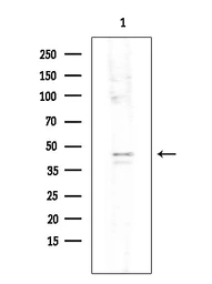 Anti-IKB alpha (phospho Ser32/Ser36) antibody used in Western Blot (WB). GTX05029