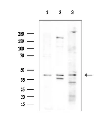 Anti-IKB alpha (phospho Ser32/Ser36) antibody used in Western Blot (WB). GTX05029