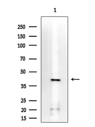Anti-IKB alpha (phospho Ser32/Ser36) antibody used in Western Blot (WB). GTX05029