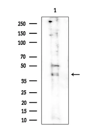 Anti-IKB alpha (phospho Ser32/Ser36) antibody used in Western Blot (WB). GTX05029