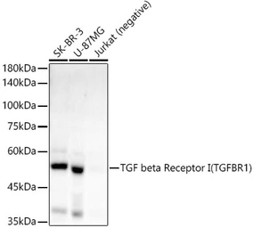Anti-TGF beta Receptor I antibody [ARC55592] used in Western Blot (WB). GTX05030
