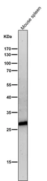 Anti-Neutrophil elastase antibody [AOCI-5] used in Western Blot (WB). GTX05032