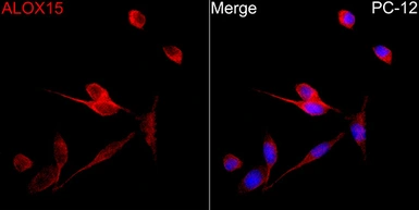 Anti-ALOX15 antibody used in Immunocytochemistry/ Immunofluorescence (ICC/IF). GTX05035