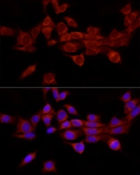 Anti-ALOX15 antibody used in Immunocytochemistry/ Immunofluorescence (ICC/IF). GTX05035