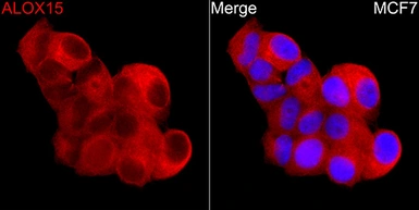Anti-ALOX15 antibody used in Immunocytochemistry/ Immunofluorescence (ICC/IF). GTX05035