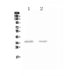 Anti-NKp46 antibody used in Western Blot (WB). GTX05036