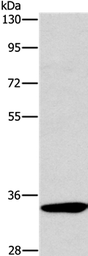 Anti-NKp46 antibody used in Western Blot (WB). GTX05037