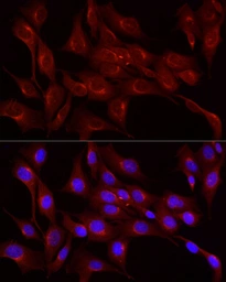 Anti-LDL Receptor antibody used in Immunocytochemistry/ Immunofluorescence (ICC/IF). GTX05038