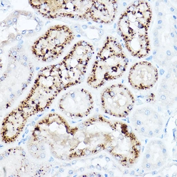 Anti-LDL Receptor antibody used in IHC (Paraffin sections) (IHC-P). GTX05038